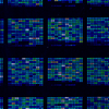 Curso IdISBa. “Análisis microarrays”